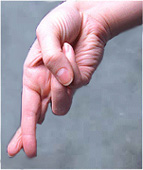 Crossed Fingers
